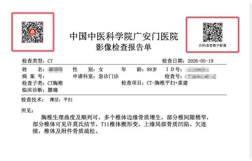 便民新舉措，就診無需實體膠片——廣安門醫院全面推行電子影像服務