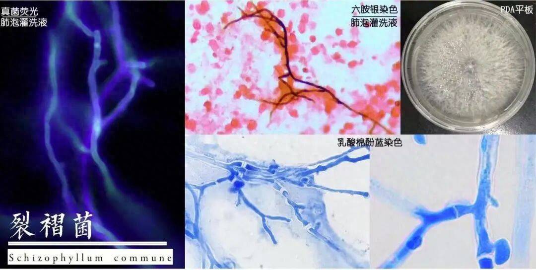 夫妻倆同時出現發熱、咳嗽，撬開家裡地板發現震驚一幕！醫生提醒