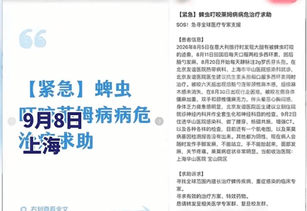 家人回應“女子在義大利疑被蜱蟲叮咬患重症”：暫不需要幫助 有論文預測氣候變暖會增強萊姆病傳播