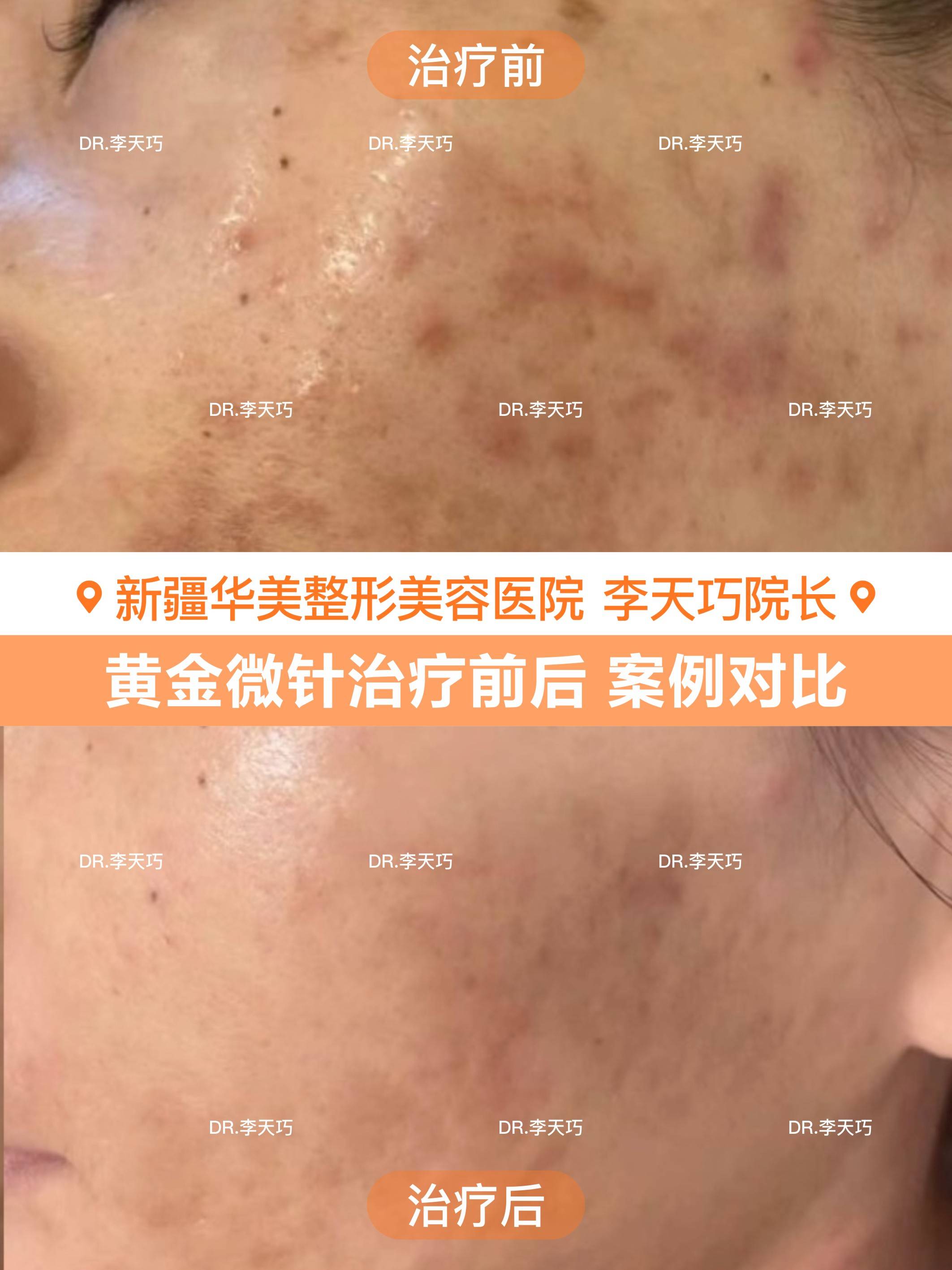 烏魯木齊 皮膚美容醫師選擇參考