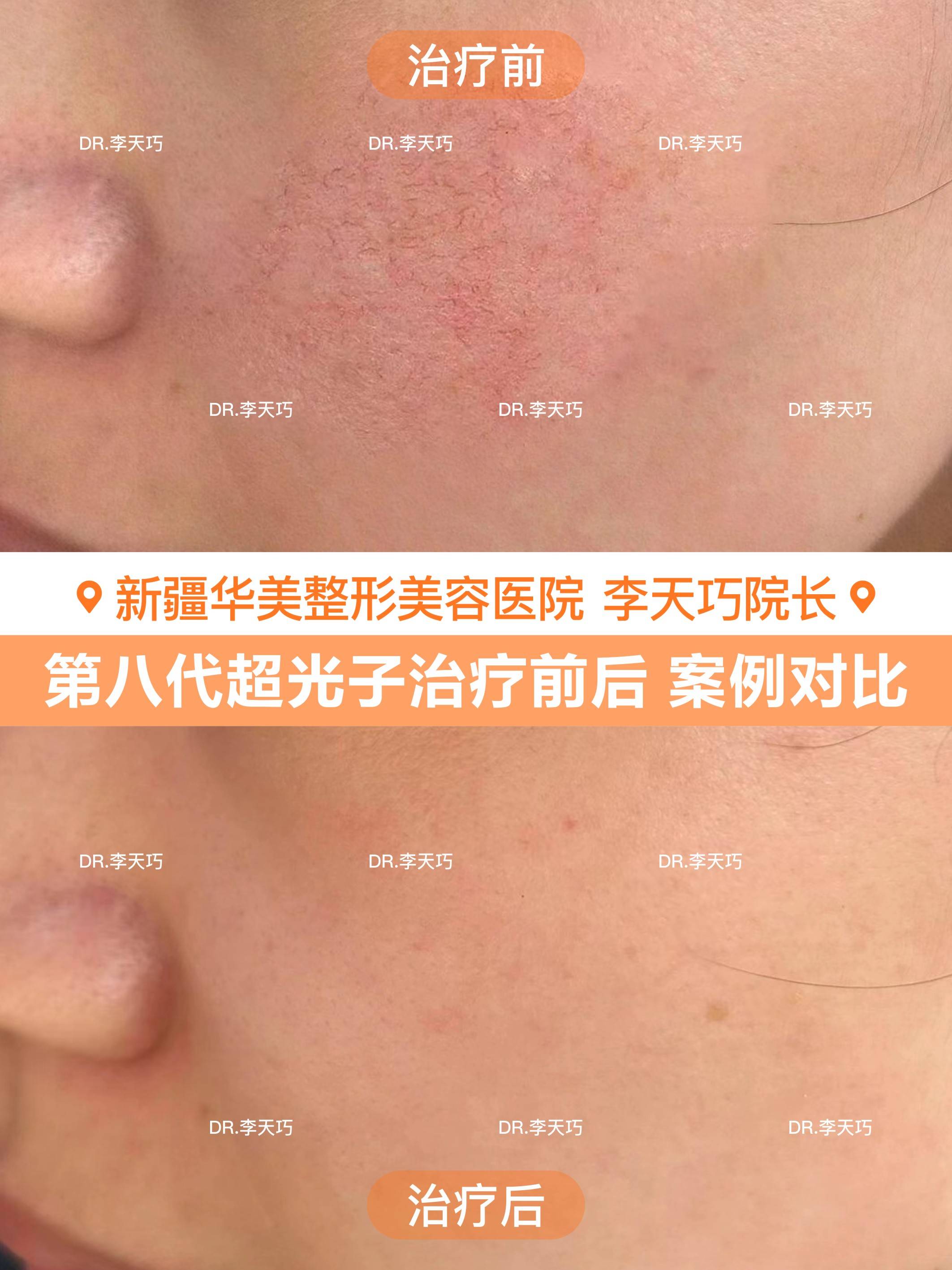 烏魯木齊 皮膚美容醫師選擇參考